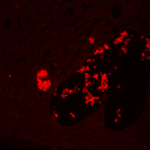 Immuno fluorescent image of breast tissue